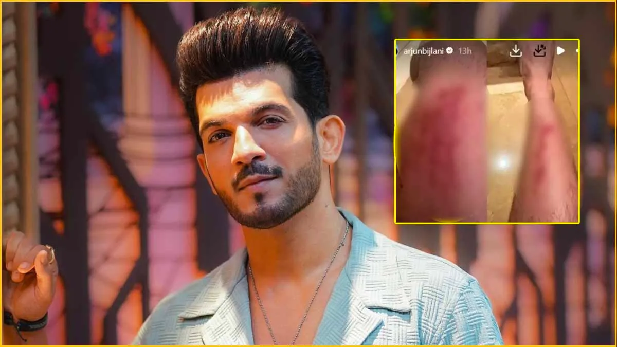 Actor Arjun Bijlani Ka Accident Hua, Goa Mein Holiday Manane Gaye They, Minor Injury Hui Abhi Theek Hain