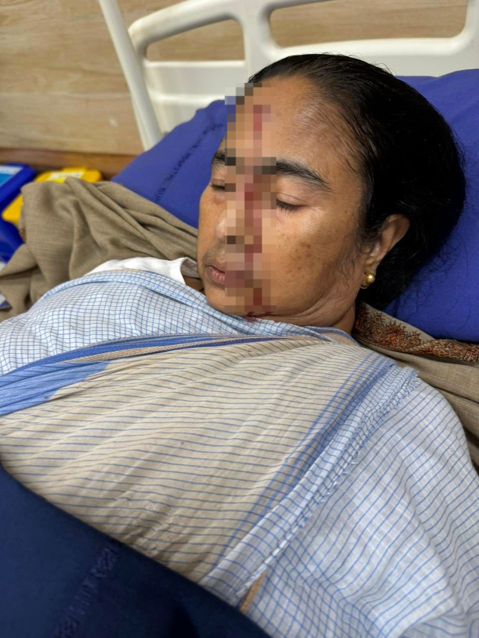 CM Mamata Banerjee Injured Hui, Apne Kalighat Home Me Girne Se, Photos Hua Viral, Condition Stable Now