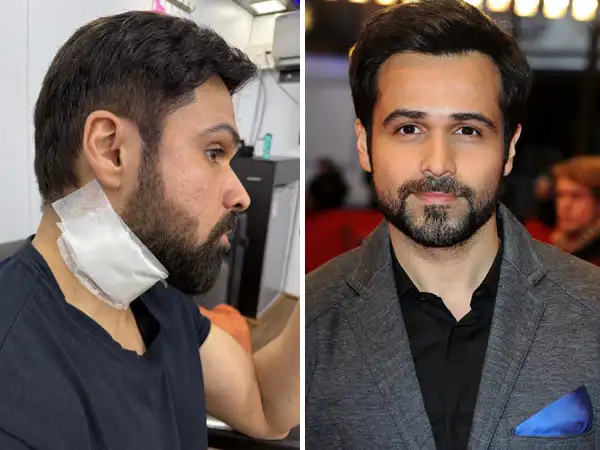 Actor Emraan Hashmi Injured During Shooting, Neck Par Hui Injury at Hyderabad