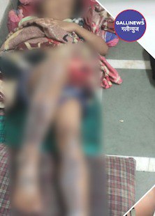 Madanpura mai Khaulta Tel gira bacchi ke upar