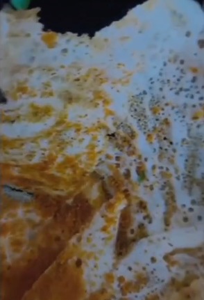 Sada Dosa me nikle 8 Cockroaches, Mahila Grahak ne Police me complaint kiya At Delhi