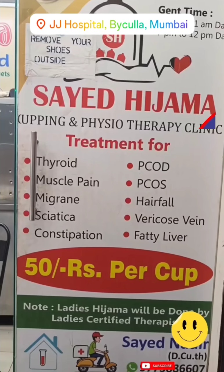 SAYED HIJAMA/CUPPING PHYSIOTHERAPY CENTER RELIEVE THE SUNNAH CURE ANY CHRONIC AND ACUTE DISEASE WITH HIJAMA