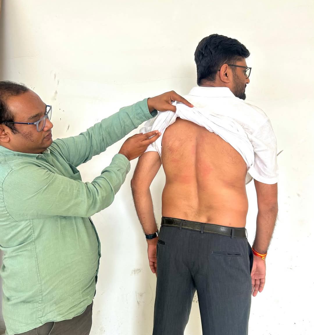 Gujrat Ki Aatma Ko Jagane Ke Liye AAP Leader Gopal Italia Ne Khud Ko Belt Se Peeta At Surat