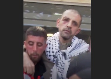 Israel ke zariye bheje gaye Falasteeni qaidiyon ki laashen par torture ke nishan — Gaza ke doctors ka daw.