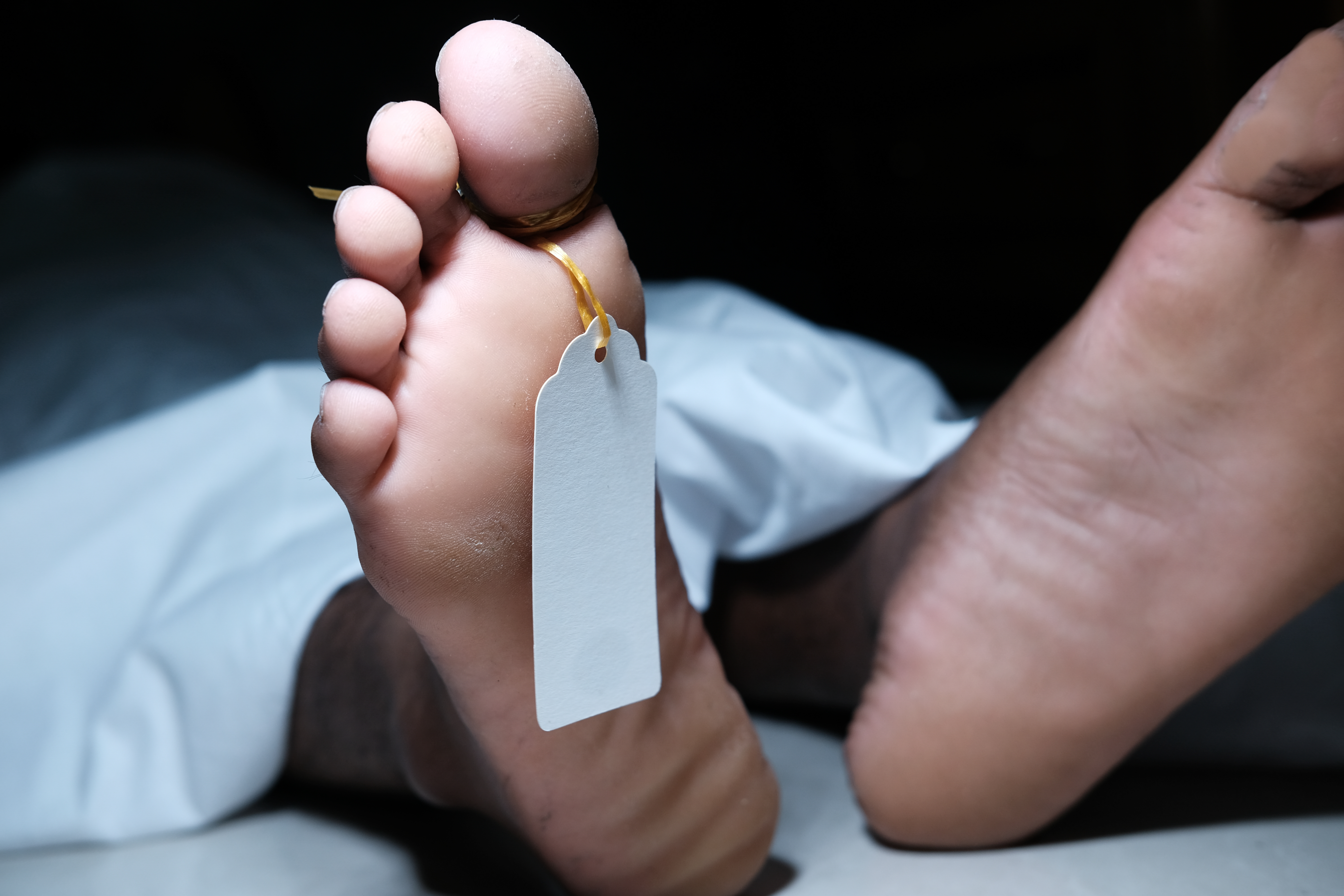 Hyderabad doctor dies by suicide after US visa rejection