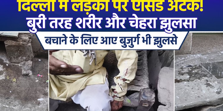 Acid attack on 24 year old girl in Bhajanpura, elderly people who saved her also got burnt